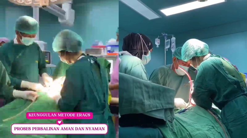 Aman bagi Pasien, Persalinan ERACS Hadir di RS Hasri Ainun Habibie