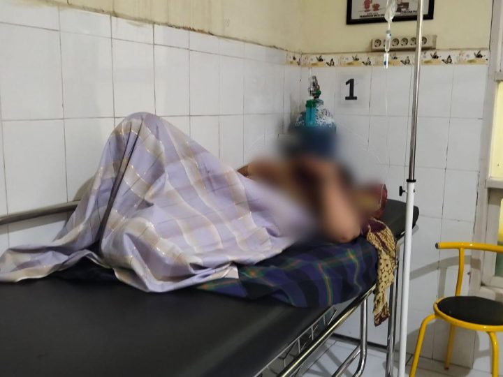 IRT di Pinrang Diduga Disiram Air Keras Suaminya